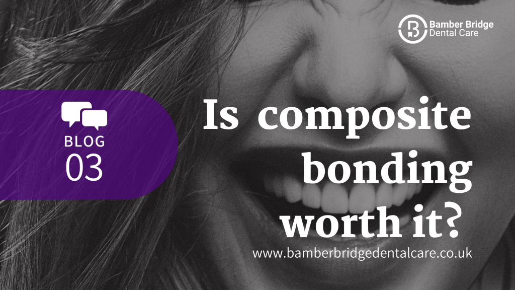 Is composite bonding worth it? Bamber Bridge Dental